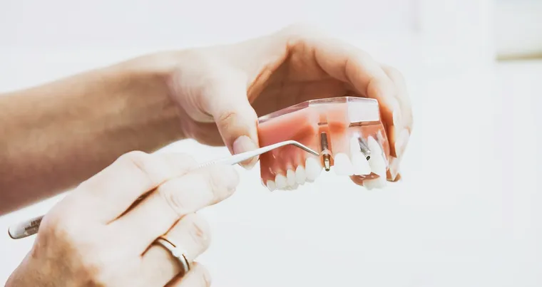 Dental Implants and Dentures: Costs and Options